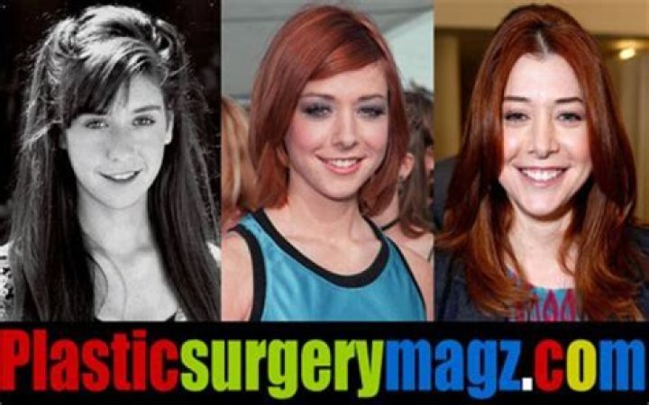 Alyson Hannigan Plastic Surgery Before and After