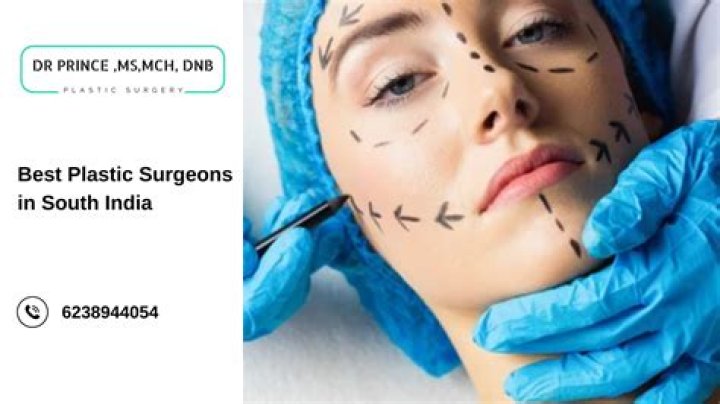 Carrot Top Plastic Surgery: Changing Lifestyle or An Excessive Surgical Transformation!