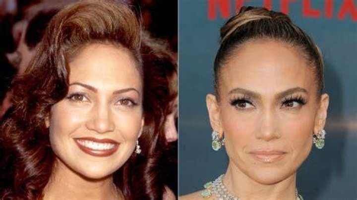 Has Jennifer Lopez had Plastic Surgery: From Rumors to Reality