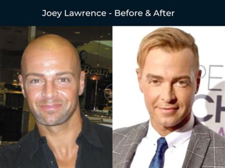 
How Much Money Does Joey Lawrence Make? Latest Income Salary
