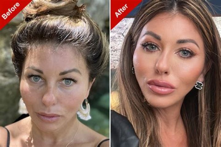 Jackie Sandler Plastic Surgery: Is Her Timeless Look a Result of Cosmetic Procedures?