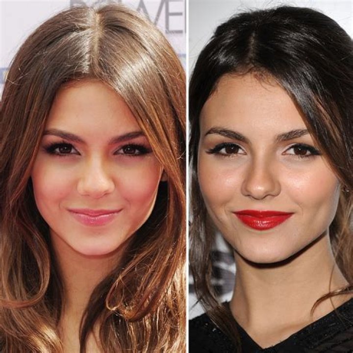 Victoria Justice Plastic Surgery Before and After
